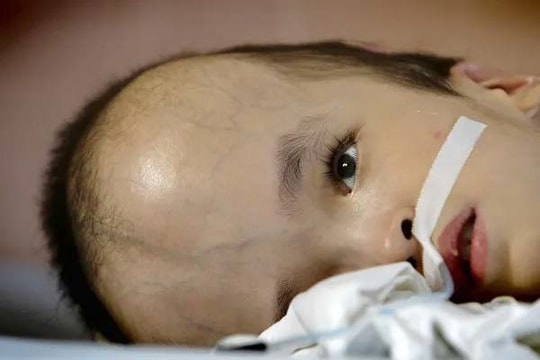 "Chiếc hộp Pandora" trong vấn đề chất da cam/dioxin